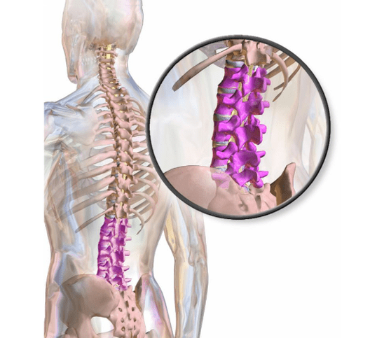 pašalinti skausmas apatinės nugaros dalies kaklo procedūros artrozė peties palaikimo