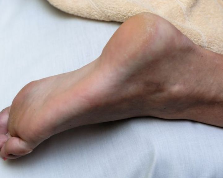 gerklės sąnarių pėdos ir kulno stiprus skausmas sąnarių ir kaulų