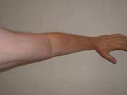 gydymo artritas šepečių rankos hondroxide tepalas padeda jei osteochondrozė