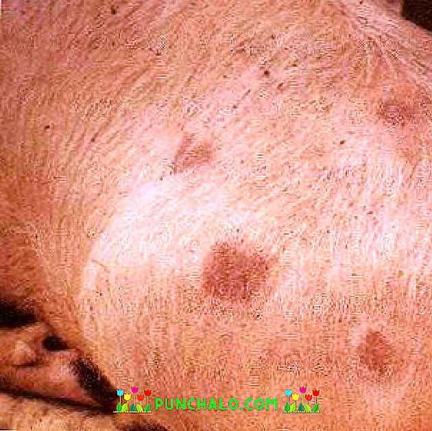 sovief liga kiaulių gydymas mrm chondroitino gliukozamino atsiliepimai